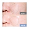 B Project. - Bye Pore Daily Tightening Pad - 120ml/60pads